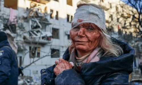 UŽAS U UKRAJINI: Ovako izgleda pravo lice rata